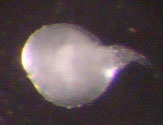 Fêmea de Meloidogyne spp.